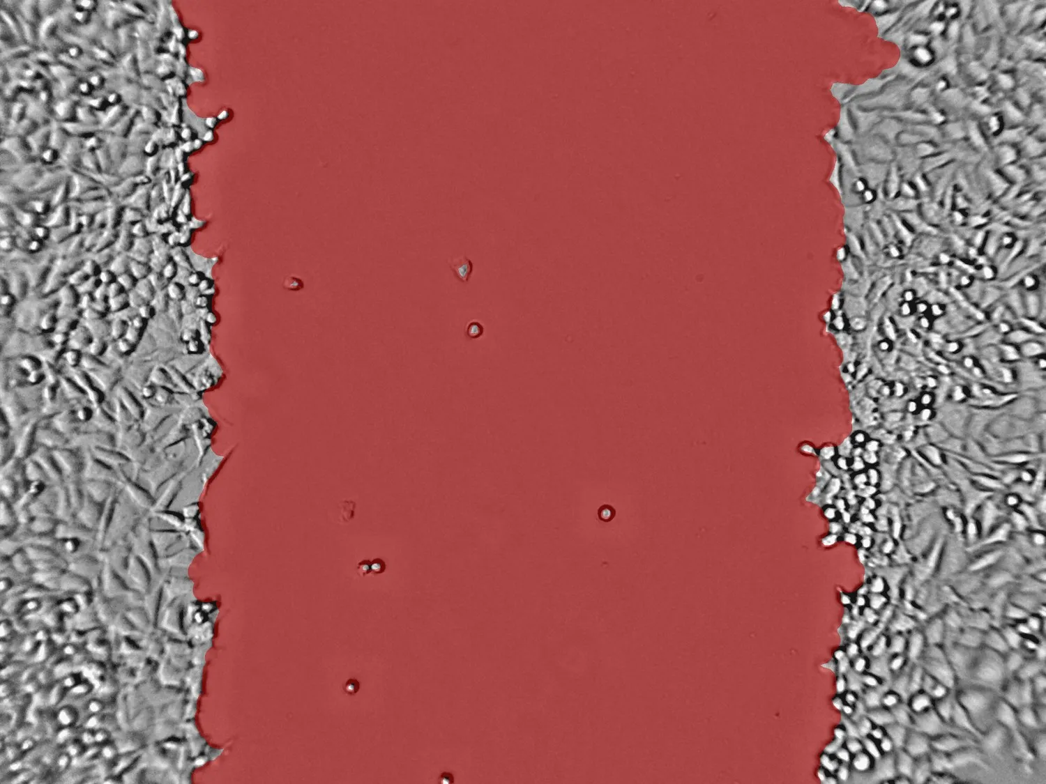 Scratch assay image with segmented wound region