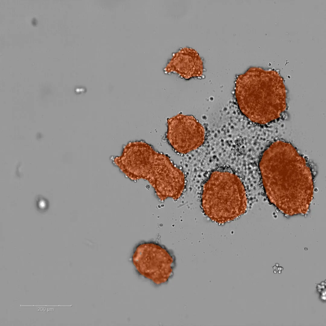Spheroid microscopy image with segmentation overlay