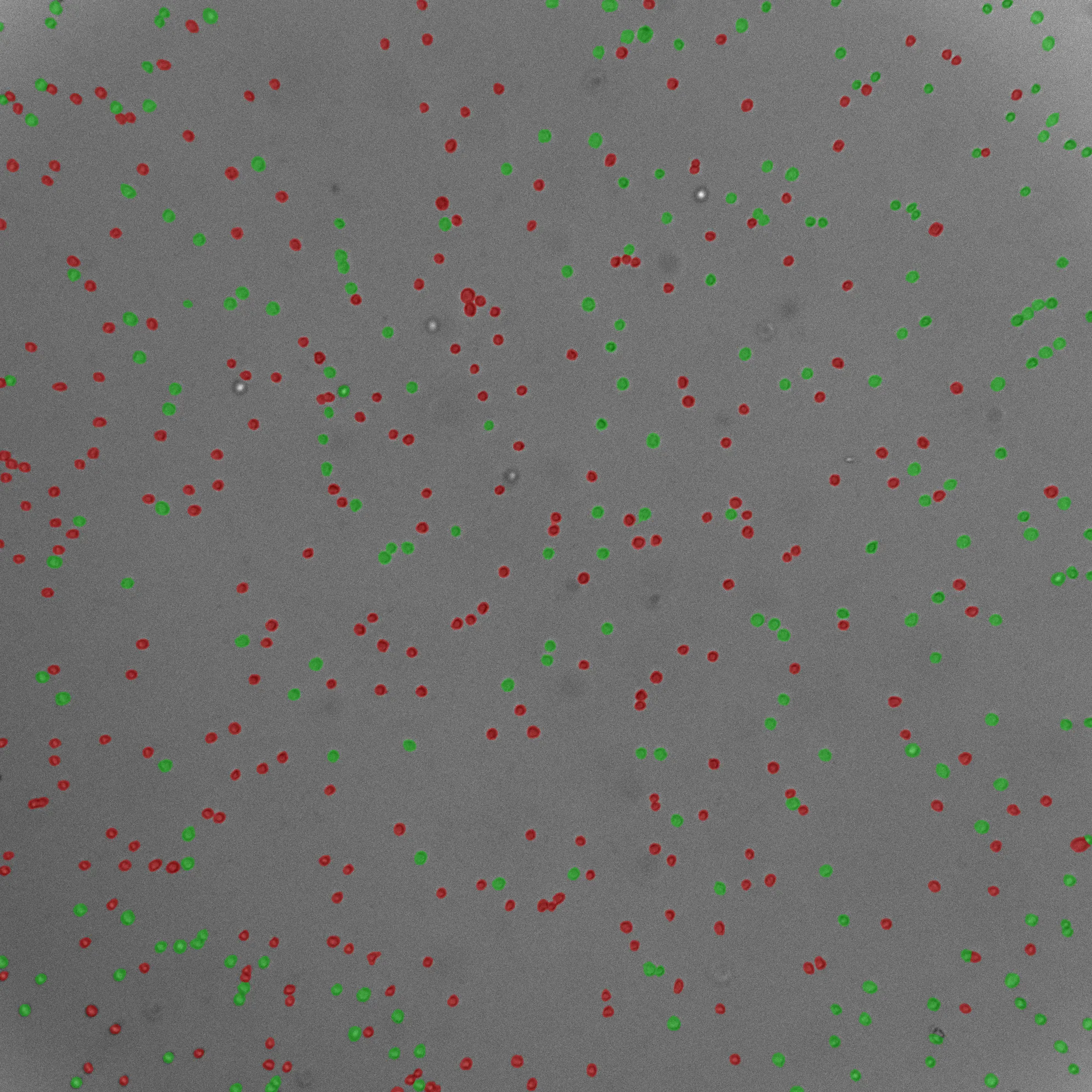 Suspension cell image with segmentation overlay