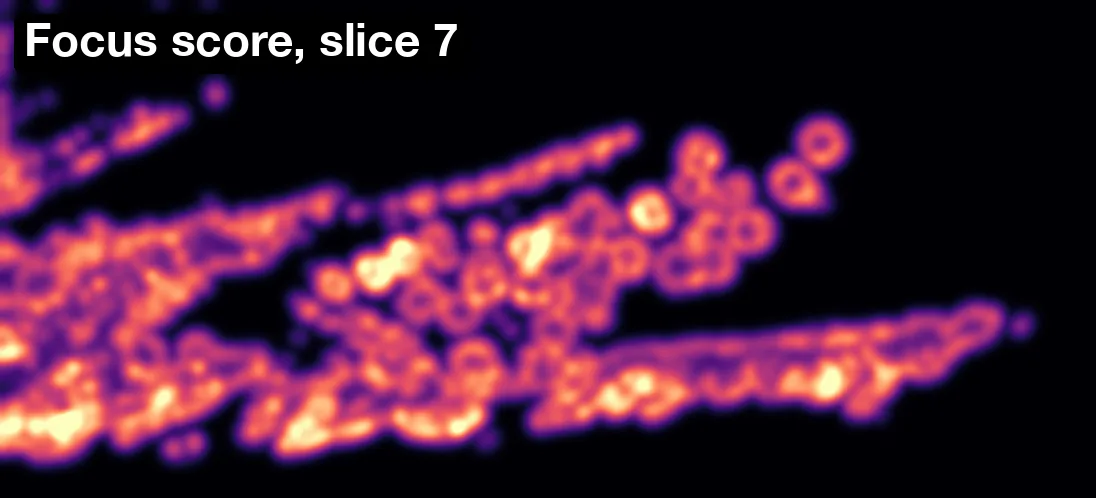 The focus score of slice 7: bright where its detail is sharp, dark where it is blurred or empty
