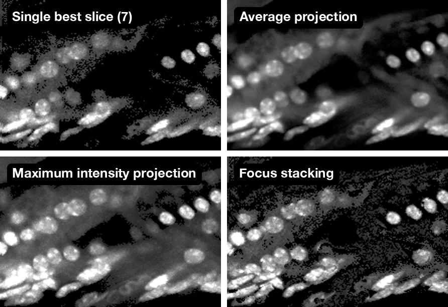 The same region flattened four ways: the single best slice, an average projection, a maximum intensity projection and focus stacking