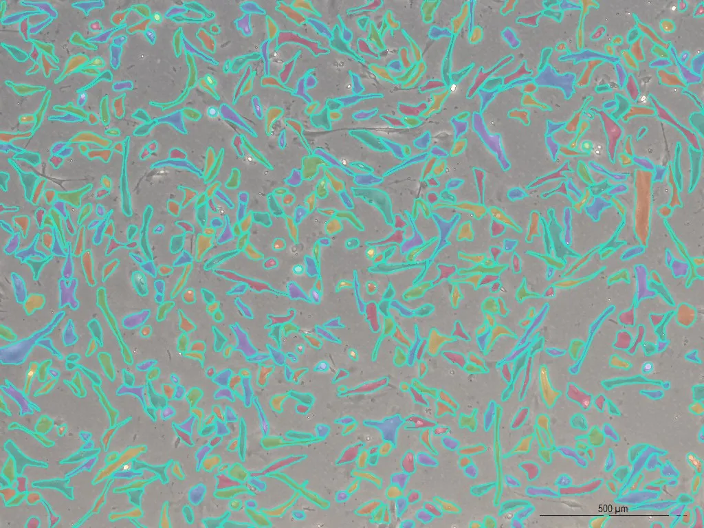 Adherent cells with segmentation outlines