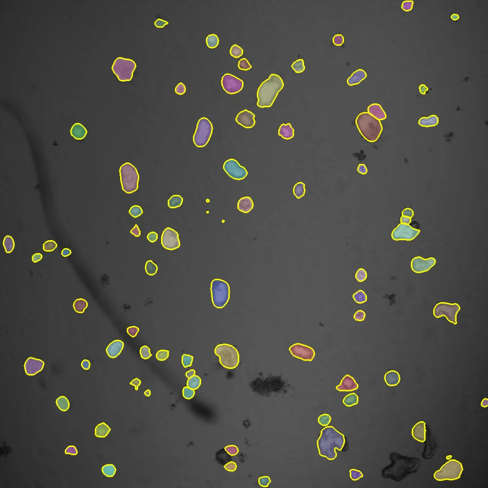 Organoids with segmentation outlines