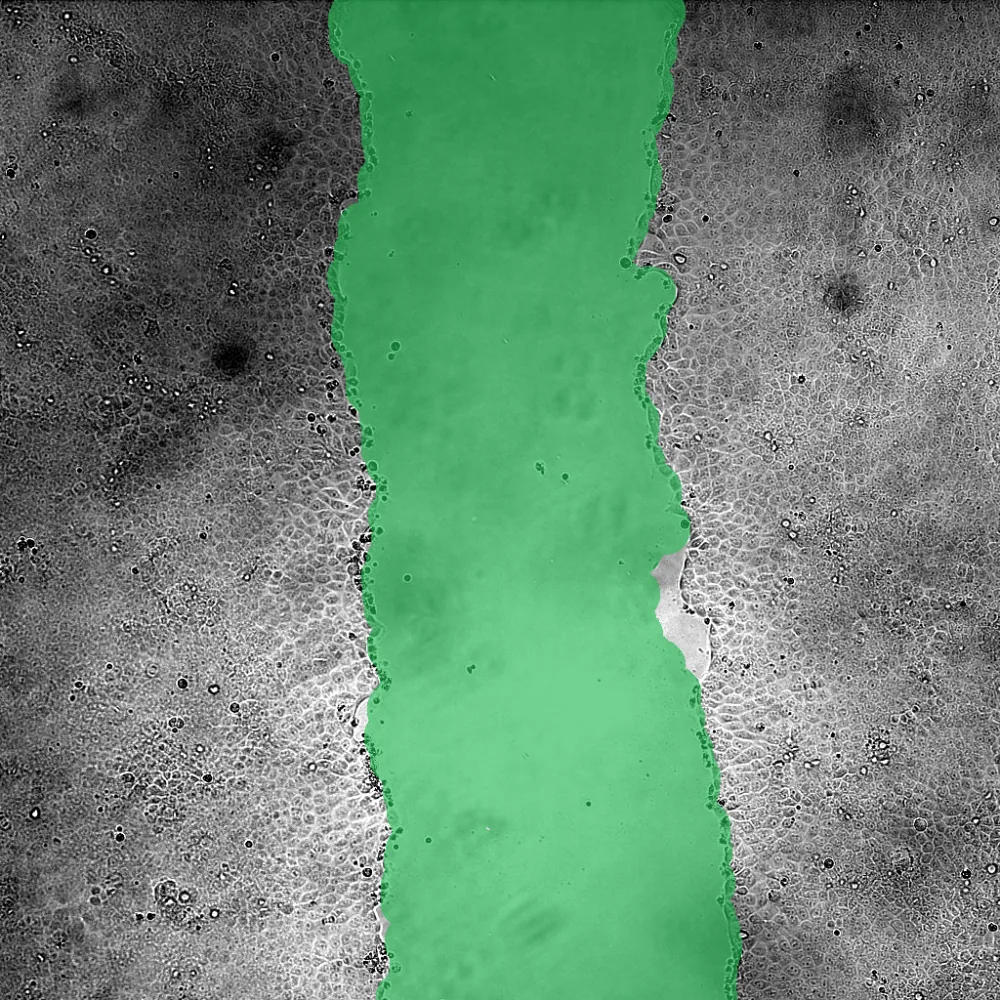 Microscopy image with the wound region highlighted